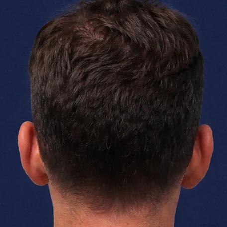 Before Image