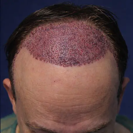 Before Image