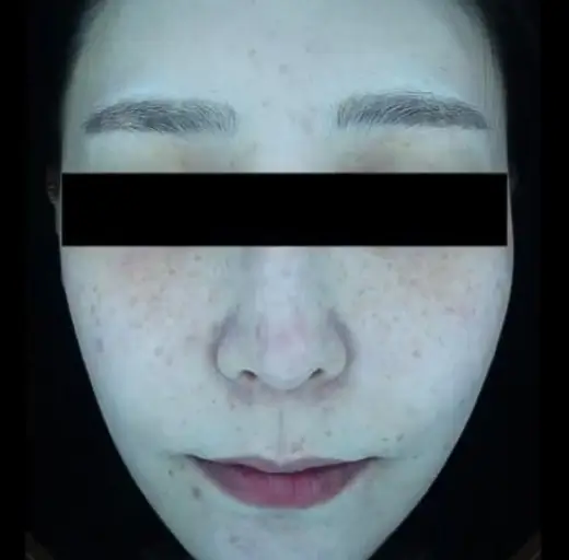 Before Image