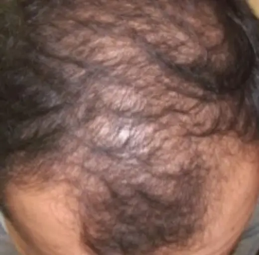 Before Image