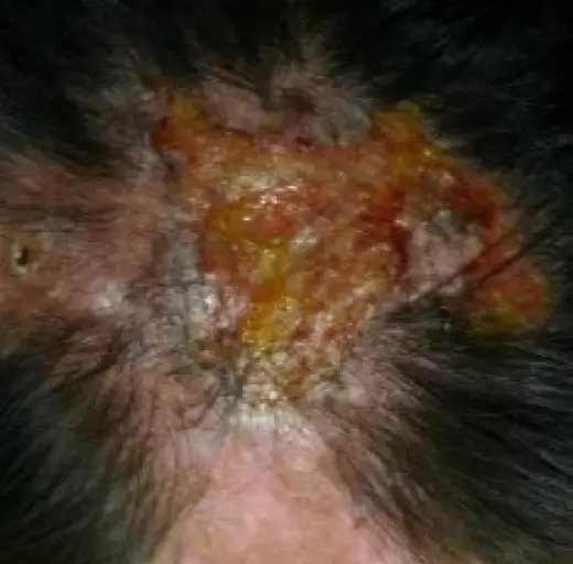 Before Image