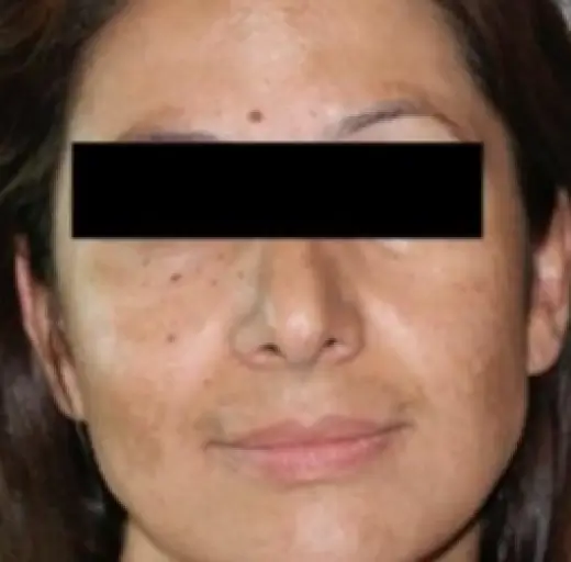 Before Image