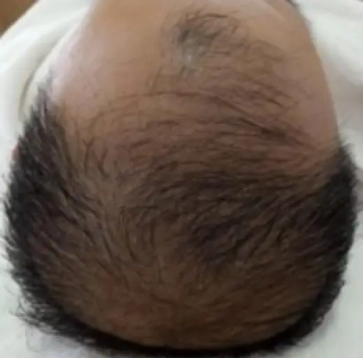 Before Image