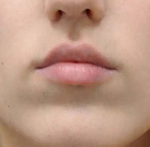 Before Image