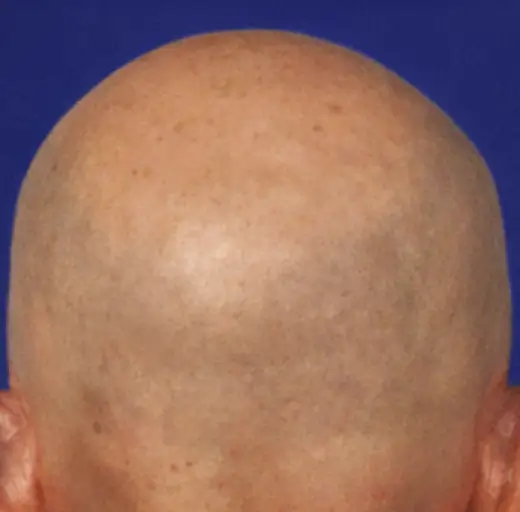Before Image