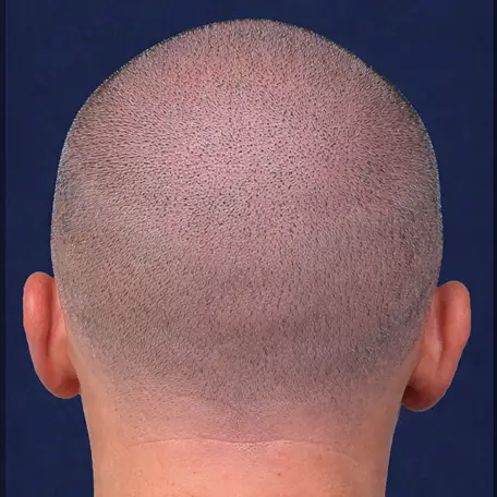 After Image