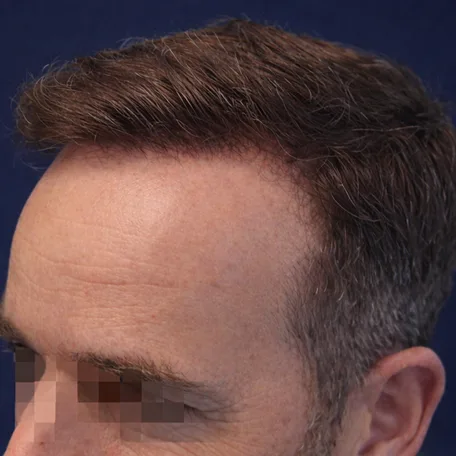 After Image
