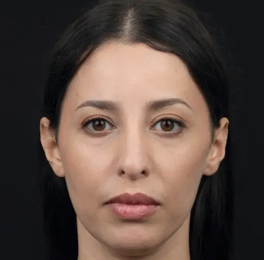 After Image