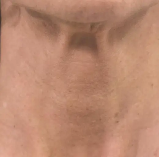 After Image