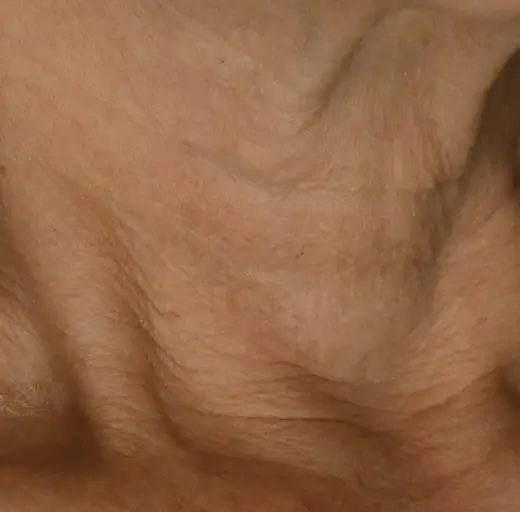 After Image