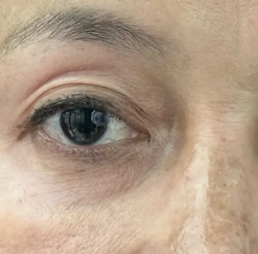 After Image