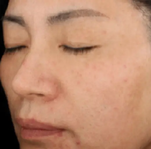 After Image
