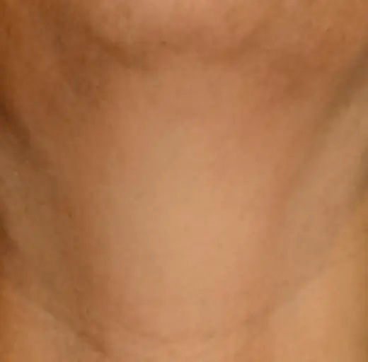 After Image