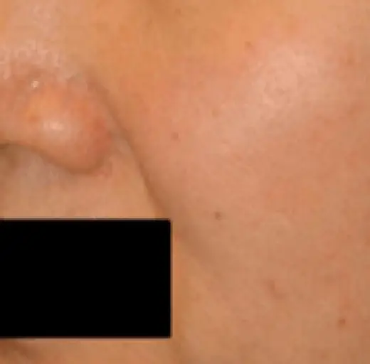 After Image