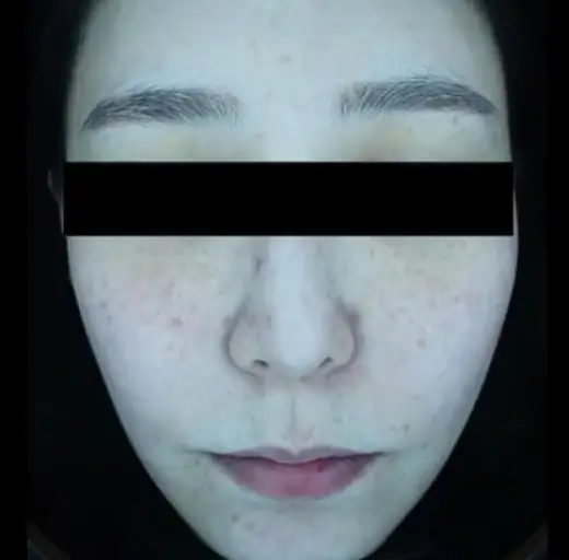 After Image