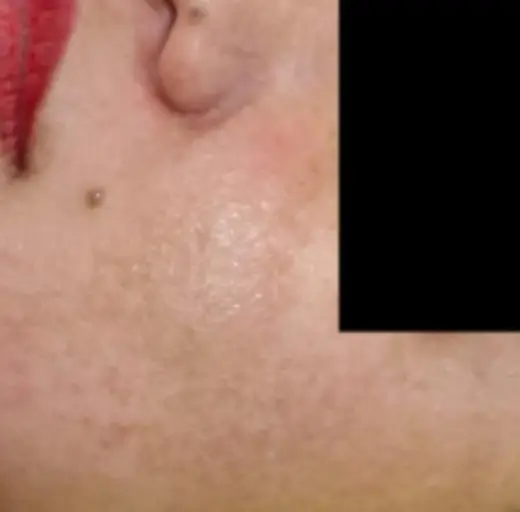 After Image