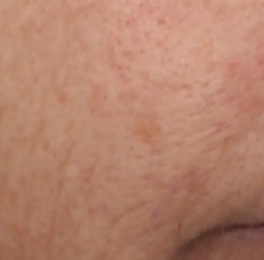 After Image