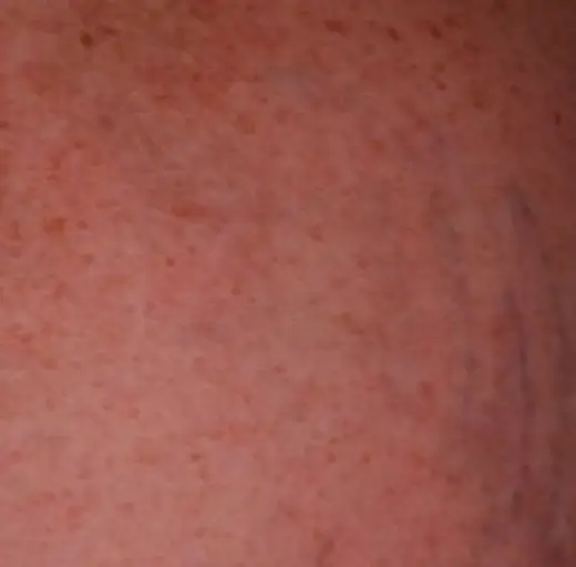 After Image