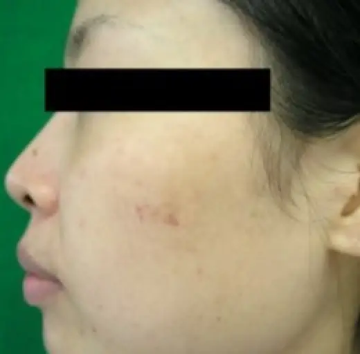 After Image