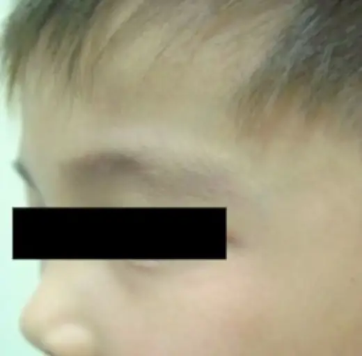 After Image