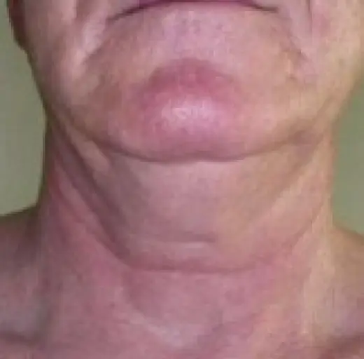 After Image