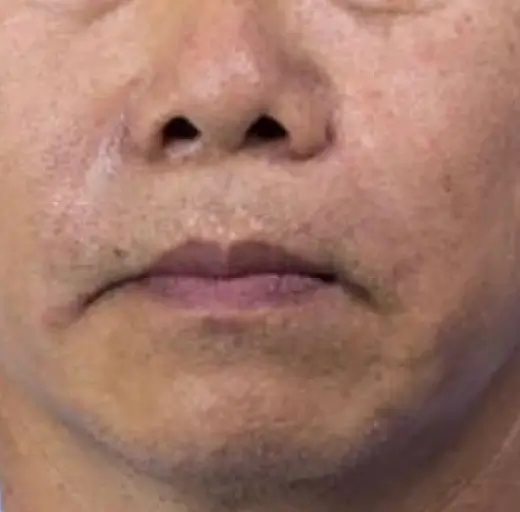 After Image