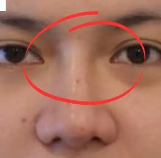After Image