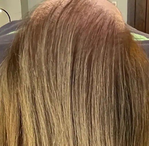 After Image