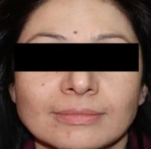 After Image