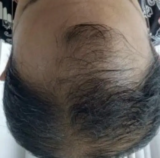 After Image