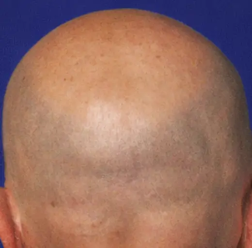 After Image